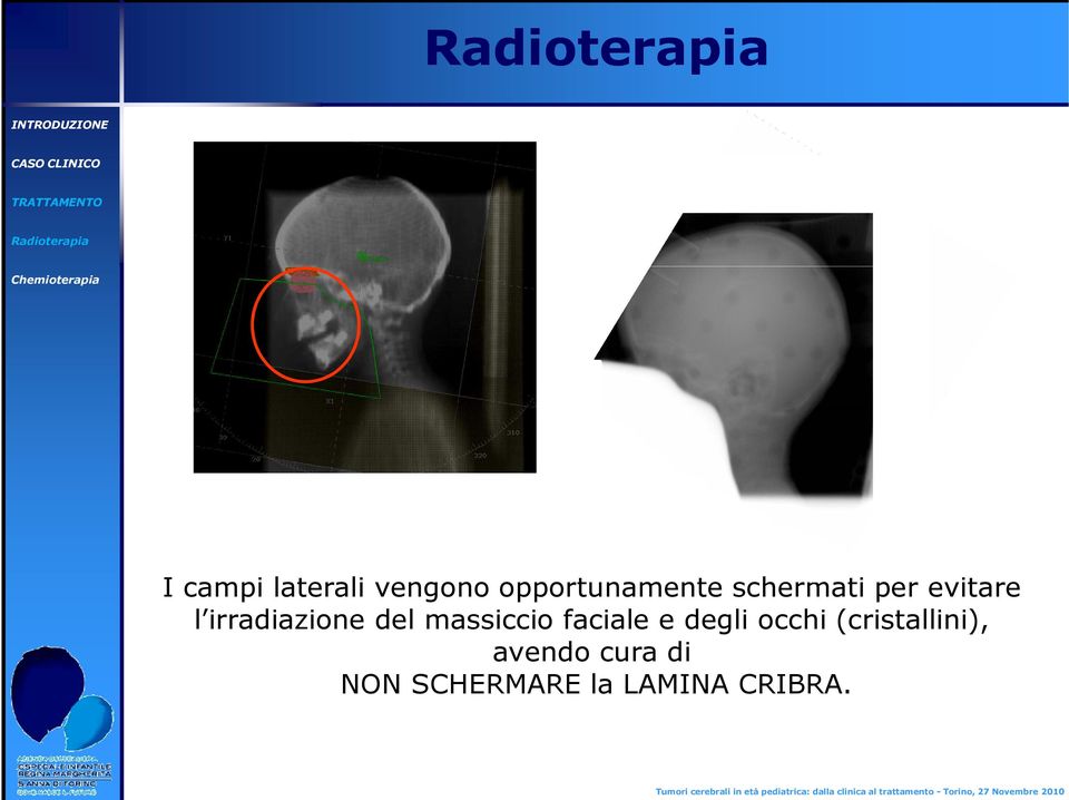 massiccio faciale e degli occhi