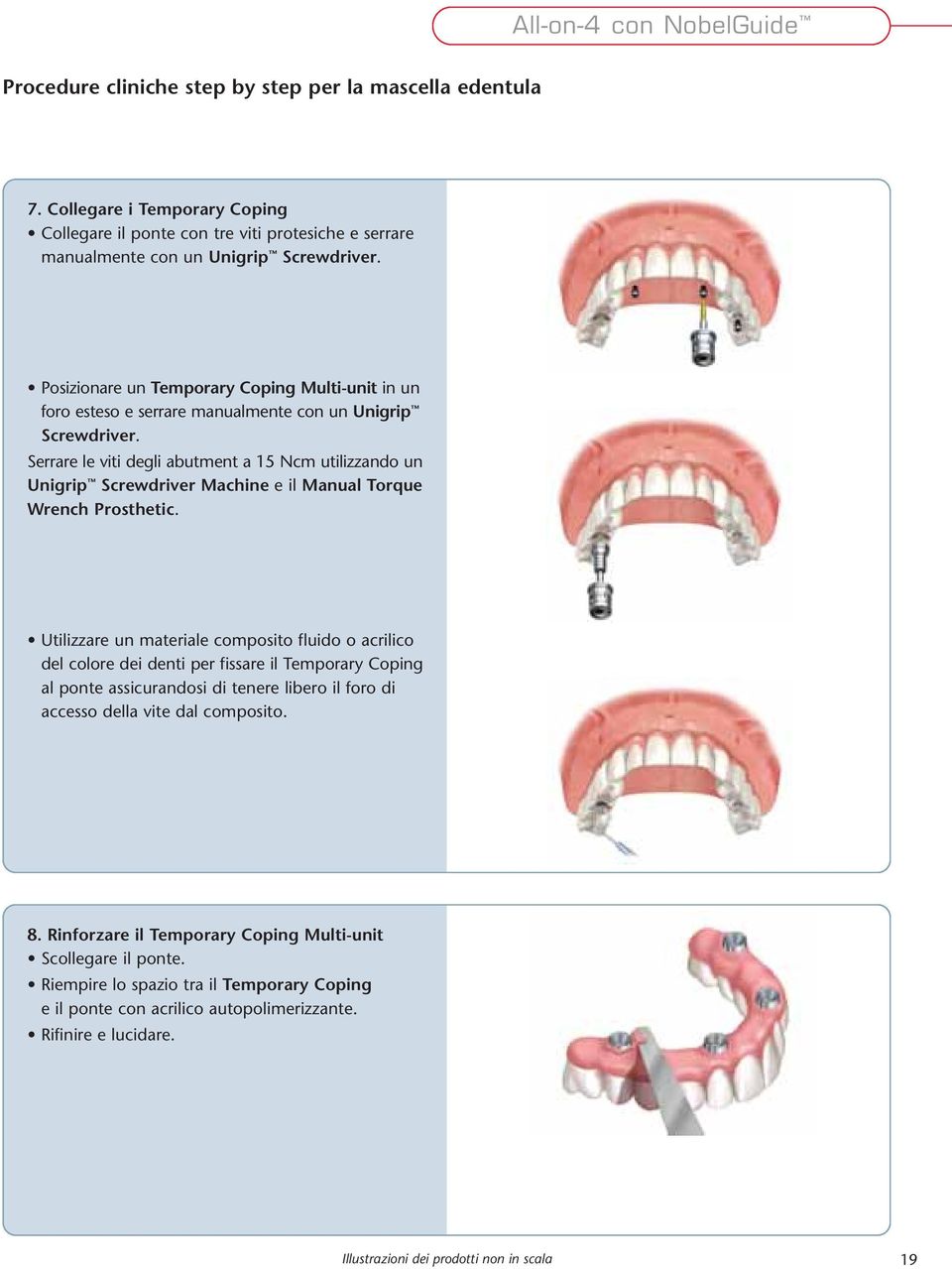 Posizionare un Temporary Coping Multi-unit in un foro esteso e serrare manualmente con un Unigrip Screwdriver.