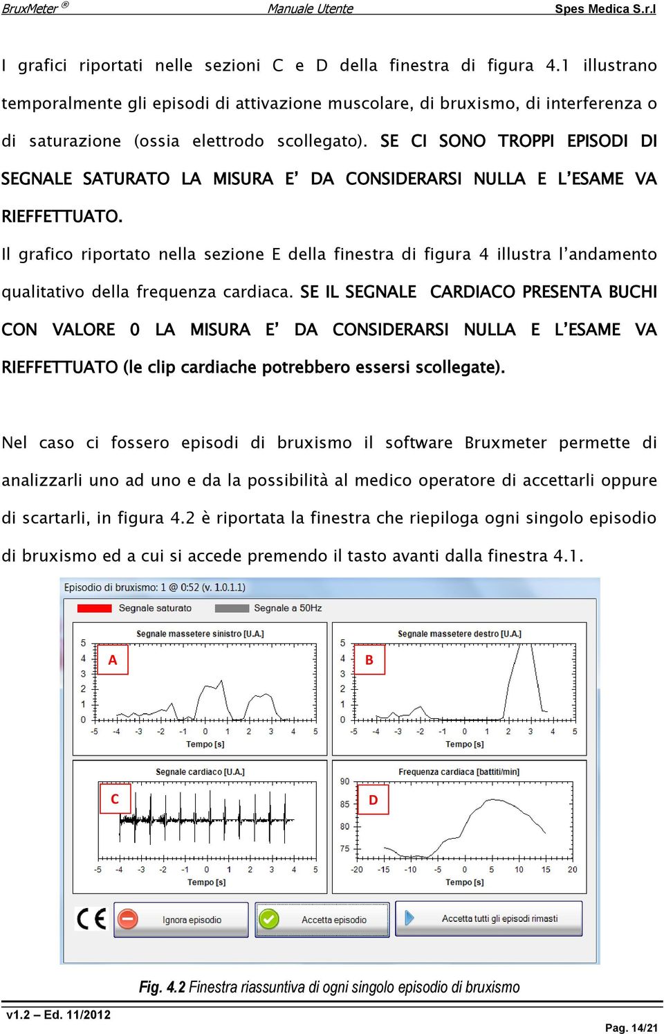 SE CI SONO TROPPI EPISODI DI SEGNALE SATURATO LA MISURA E DA CONSIDERARSI NULLA E L ESAME VA RIEFFETTUATO.