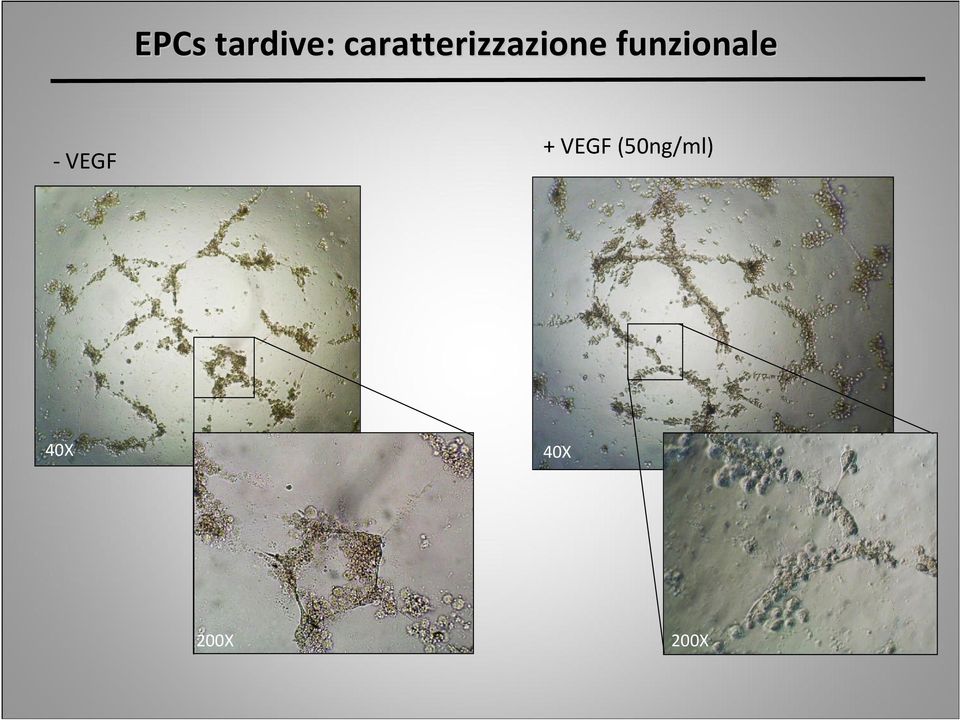 funzionale - VEGF +