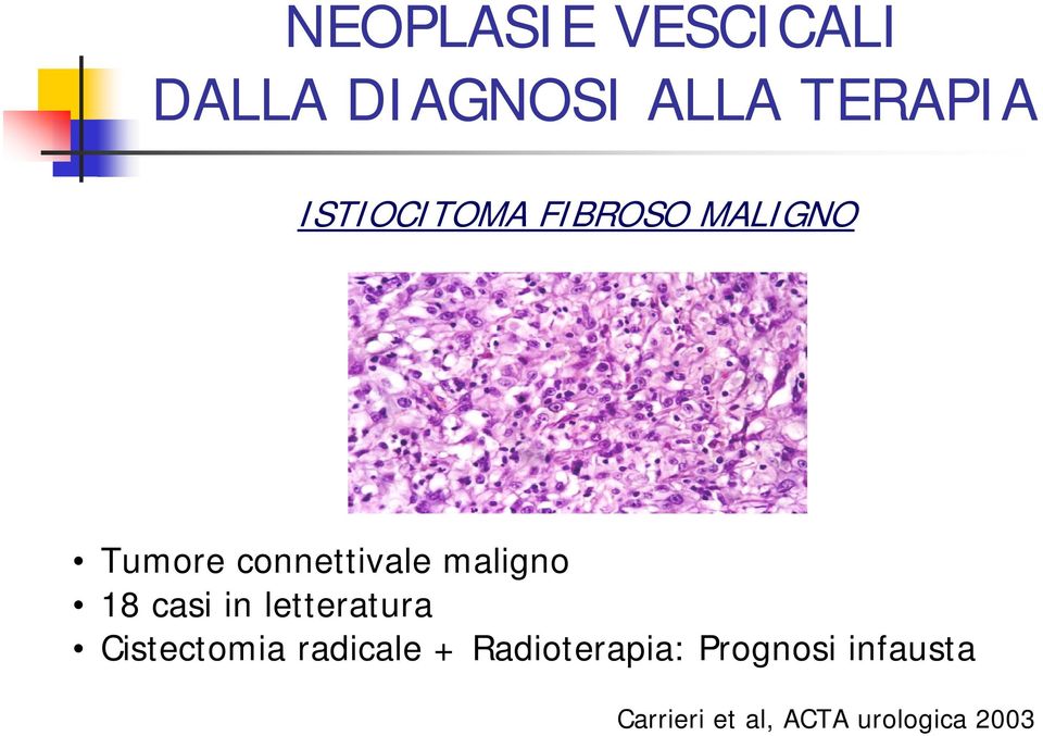 letteratura Cistectomia radicale +