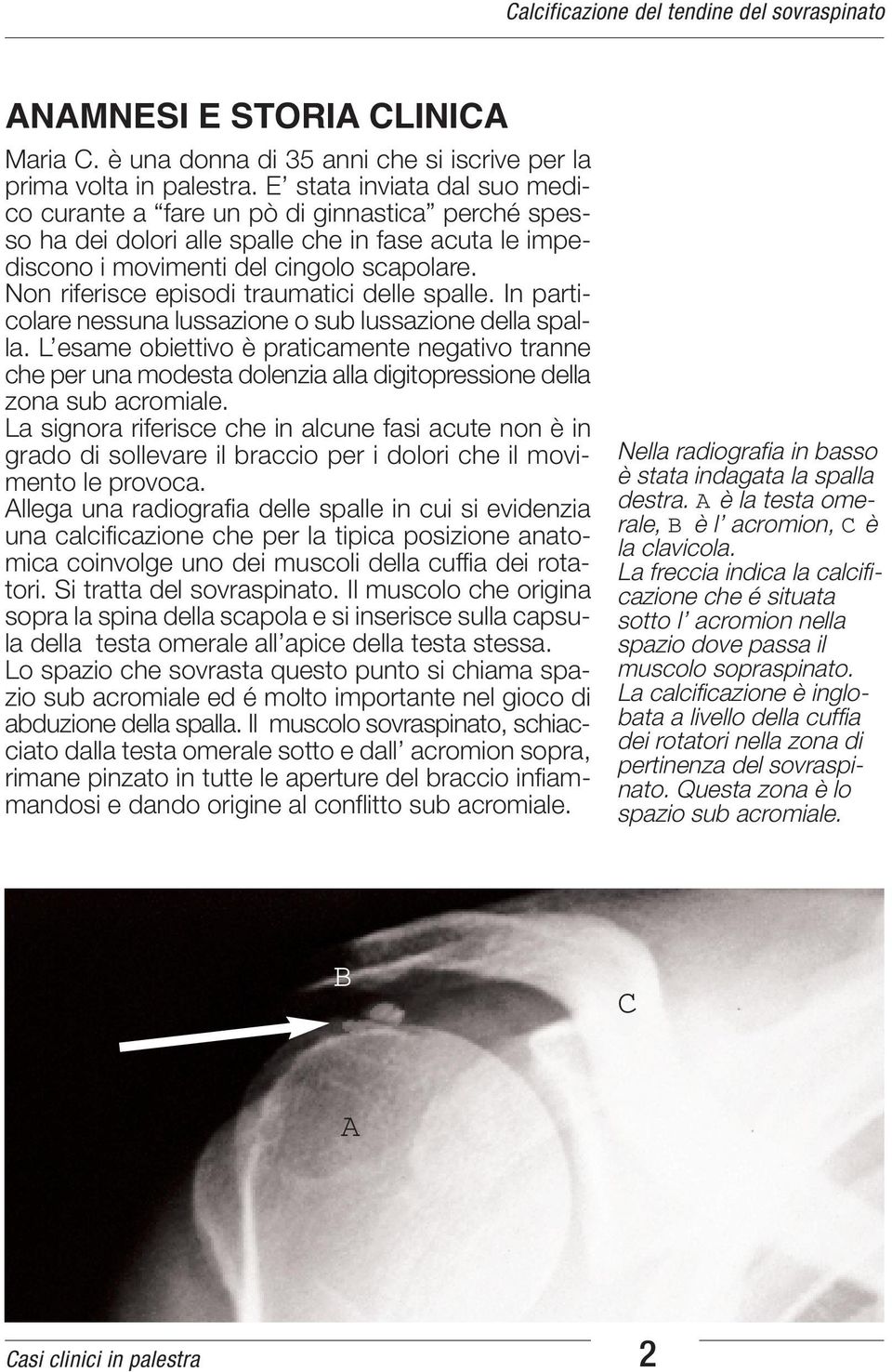 Non riferisce episodi traumatici delle spalle. In particolare nessuna lussazione o sub lussazione della spalla.