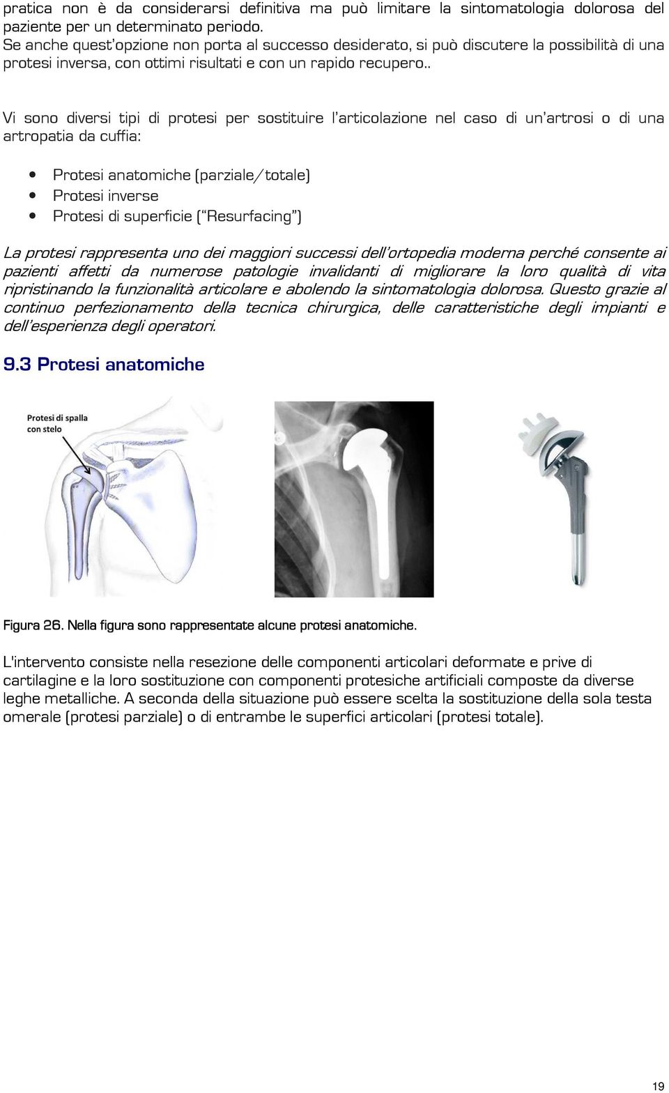 . Vi sono diversi tipi di protesi per sostituire l articolazione nel caso di un artrosi o di una artropatia da cuffia: Protesi anatomiche (parziale/totale) Protesi inverse Protesi di superficie (