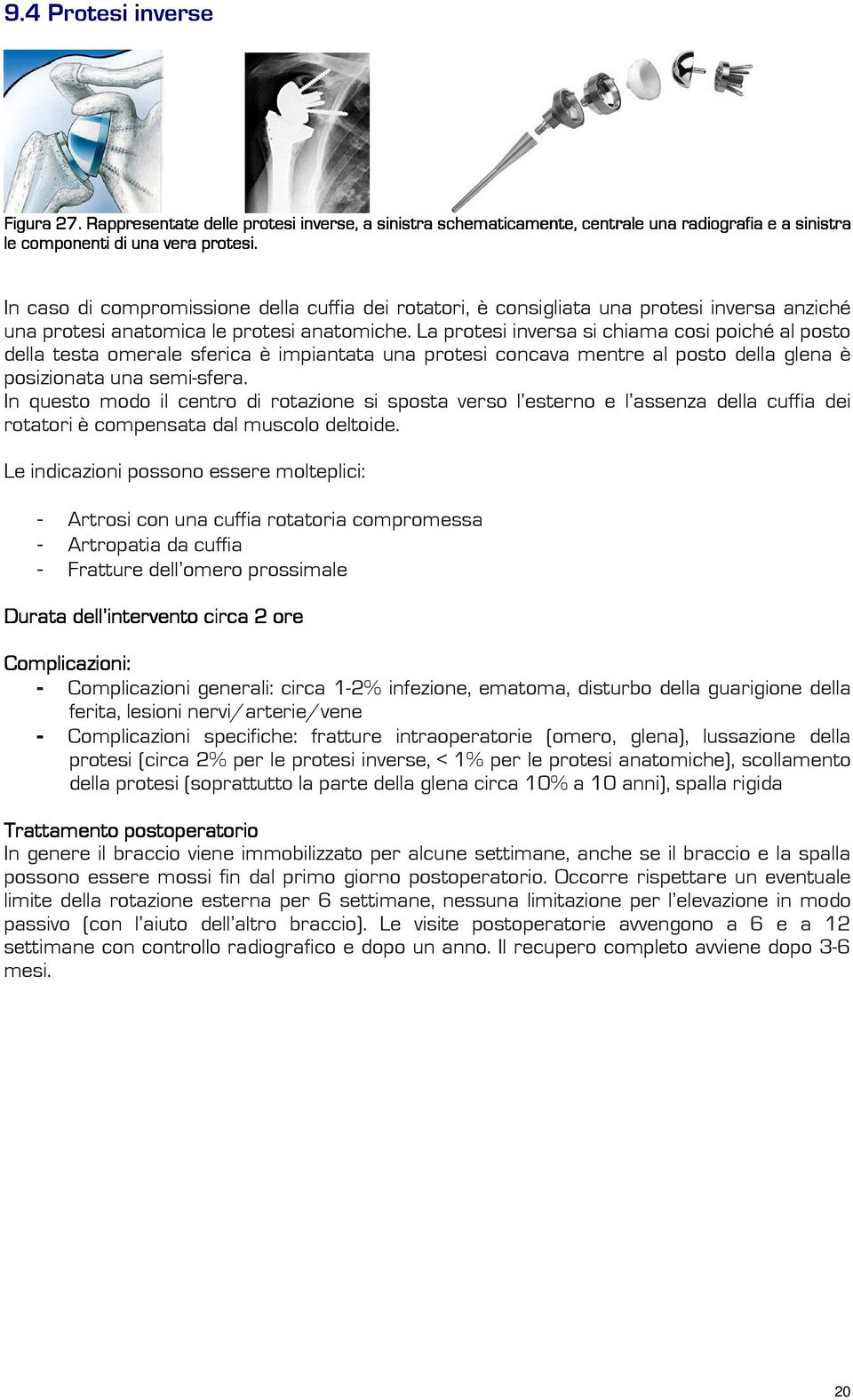 La protesi inversa si chiama cosi poiché al posto della testa omerale sferica è impiantata una protesi concava mentre al posto della glena è posizionata una semi-sfera.