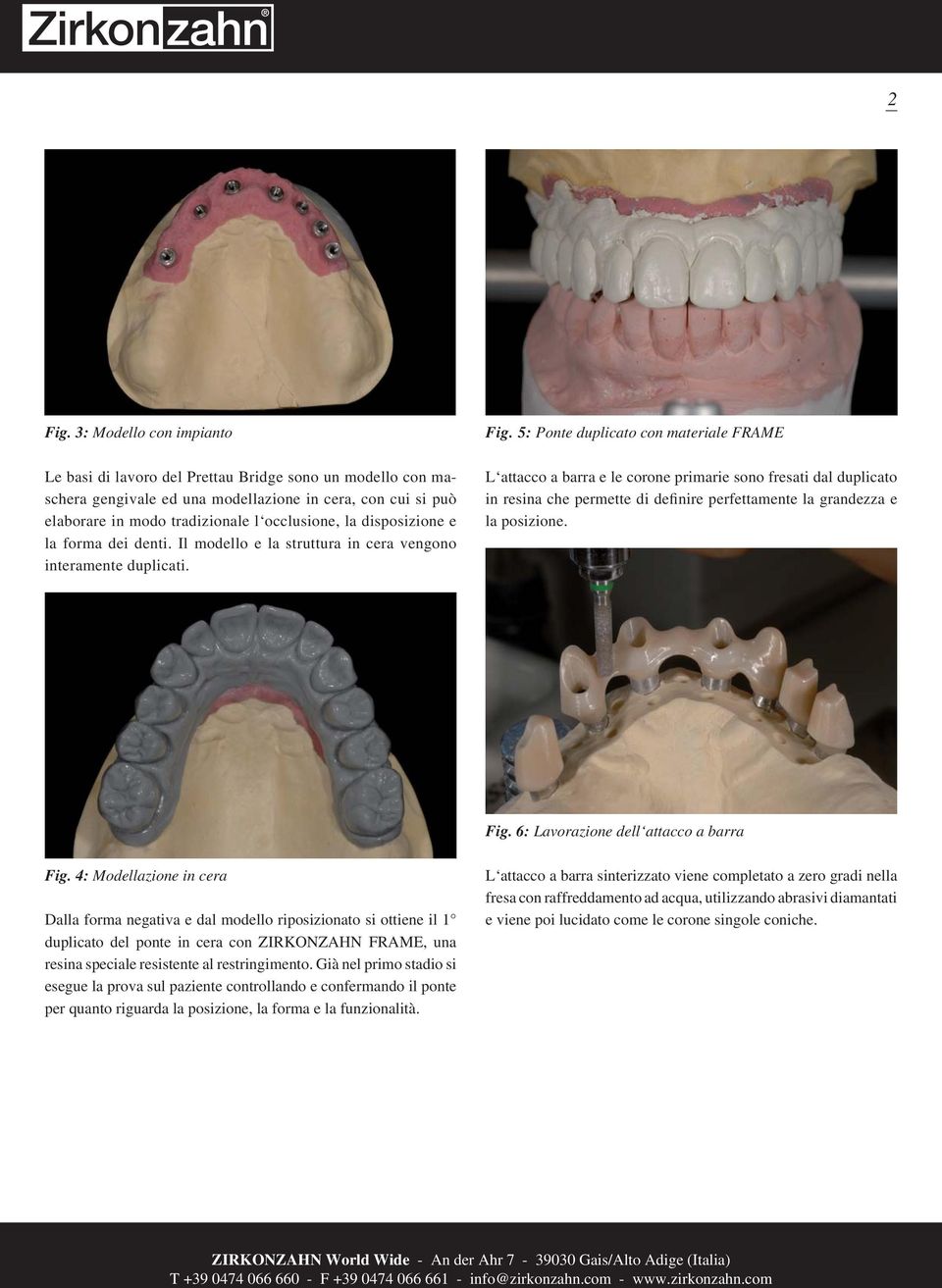disposizione e la forma dei denti. Il modello e la struttura in cera vengono interamente duplicati. Fig.