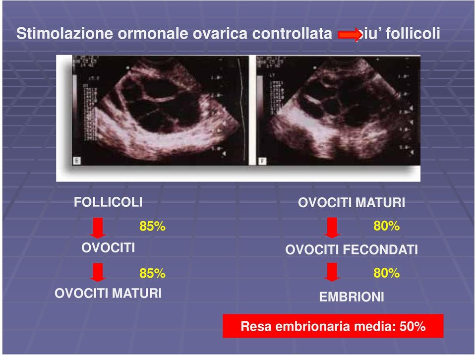 OVOCITI 85% 80% OVOCITI FECONDATI 85%