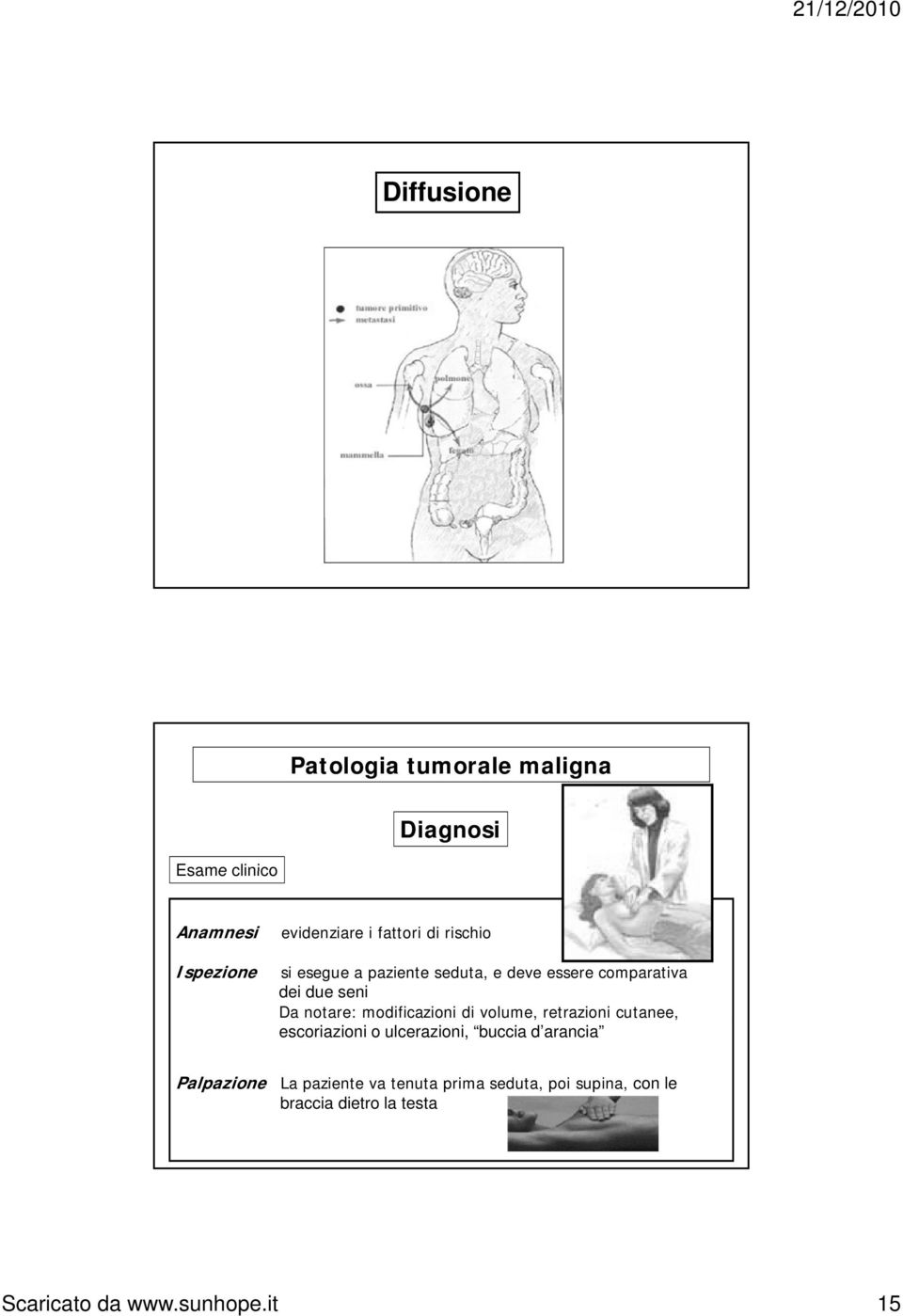 volume, retrazioni cutanee, escoriazioni o ulcerazioni, buccia d arancia Palpazione La