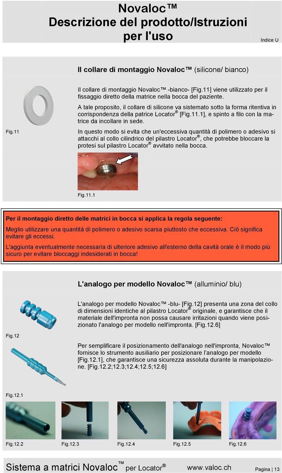 In questo modo si evita che un'eccessiva quantità di polimero o adesivo si attacchi al collo cilindrico del pilastro Locator, che potrebbe bloccare la protesi sul pilastro Locator avvitato nella