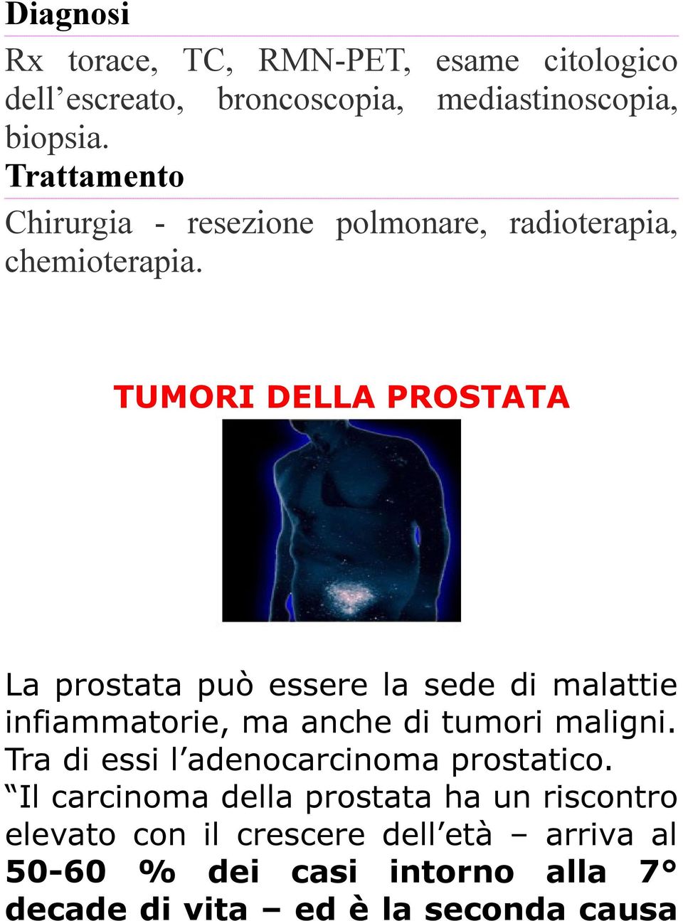 TUMORI DELLA PROSTATA La prostata può essere la sede di malattie infiammatorie, ma anche di tumori maligni.
