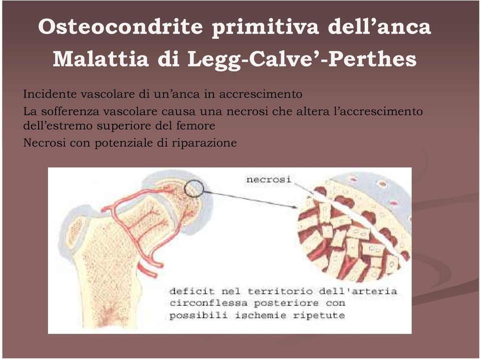 sofferenza vascolare causa una necrosi che altera l