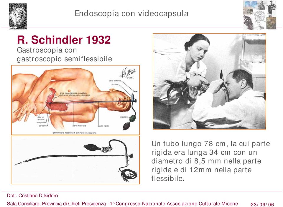 semiflessibile Un tubo lungo 78 cm, la cui parte rigida