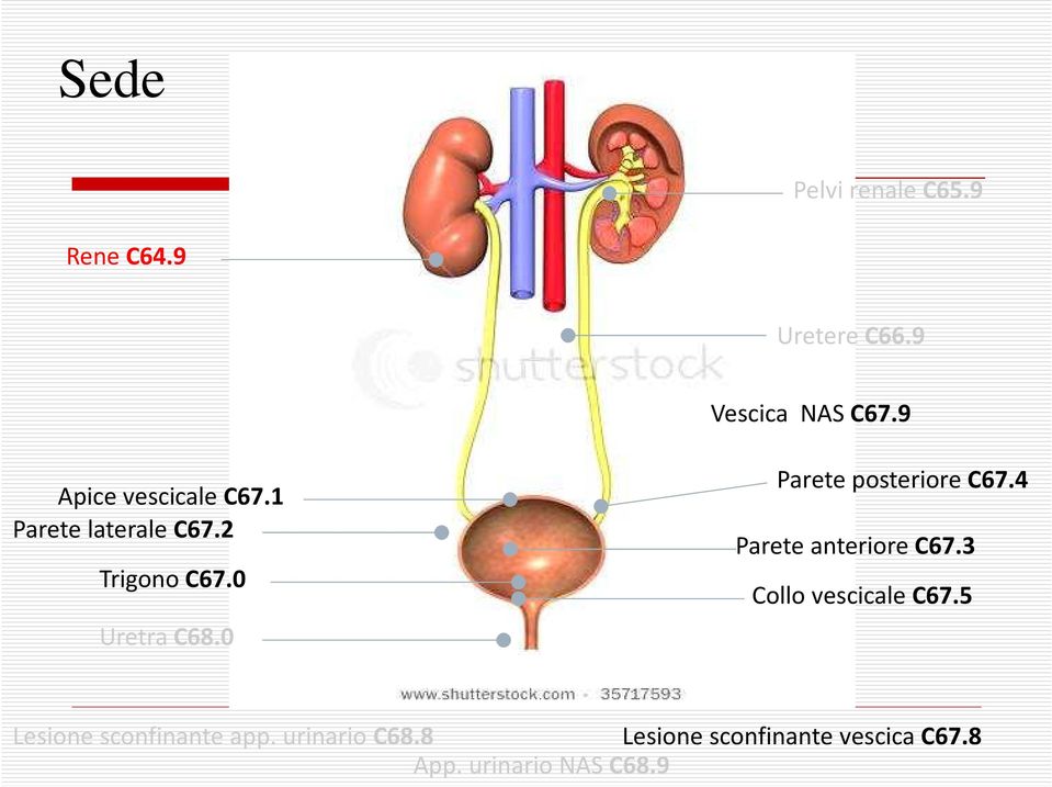 0 Parete posteriore C67.4 Parete anteriore C67.3 Collo vescicale C67.