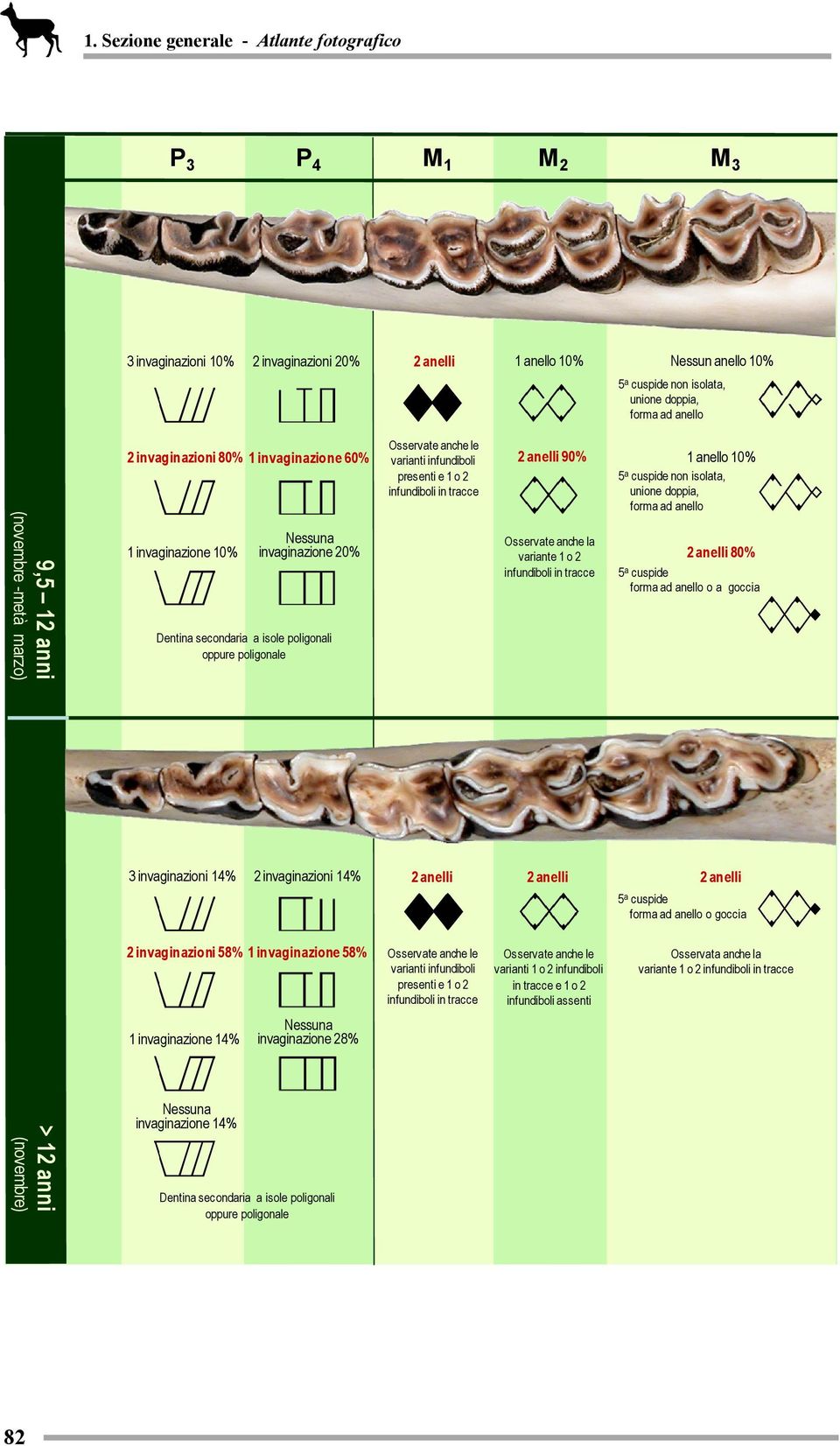 infundiboli presenti e 1 o 2 infundiboli in tracce 2 anelli 90% Osservate anche la variante 1 o 2 infundiboli in tracce 1 anello 10% non isolata, unione doppia, forma ad anello 2 anelli 80% forma ad