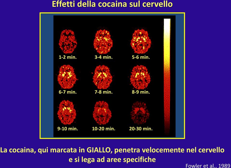 , 1989 Effetti della cocaina sul cervello 1-2 min. 3-4 min.