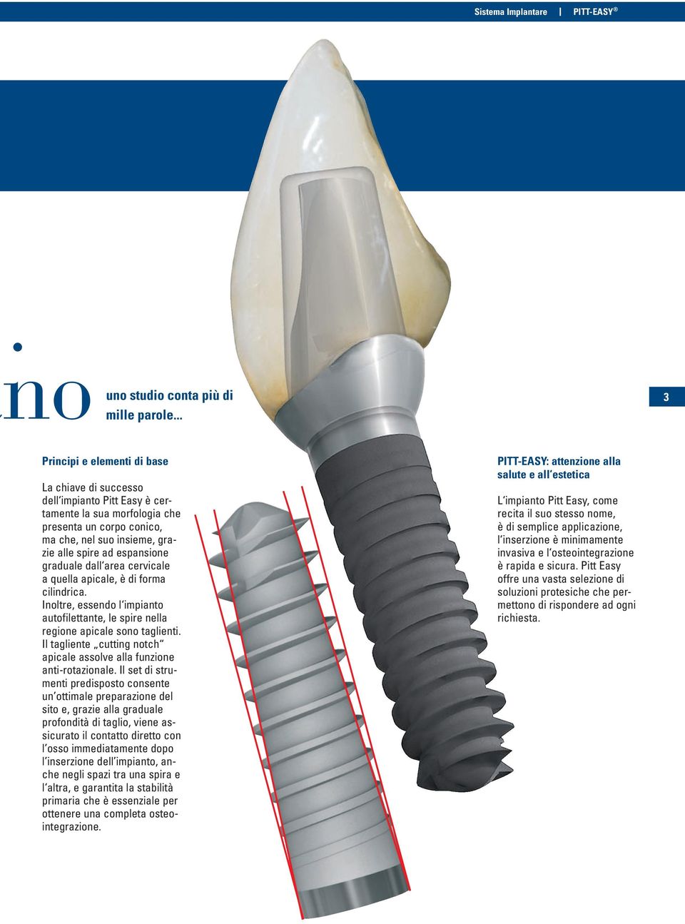 graduale dall area cervicale a quella apicale, è di forma cilindrica. Inoltre, essendo l impianto autofilettante, le spire nella regione apicale sono taglienti.