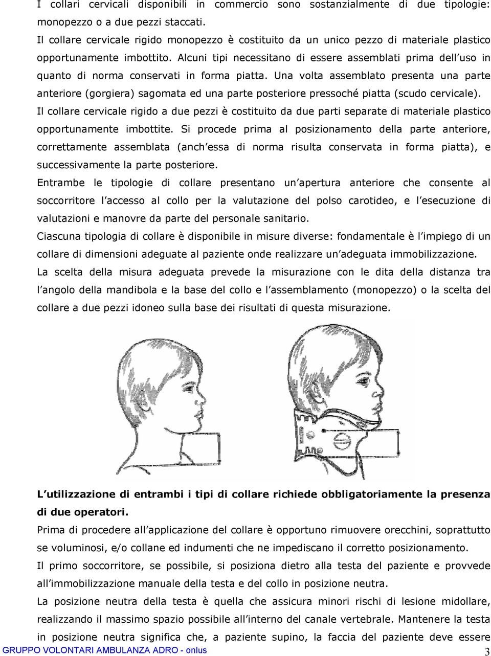 Alcuni tipi necessitano di essere assemblati prima dell uso in quanto di norma conservati in forma piatta.