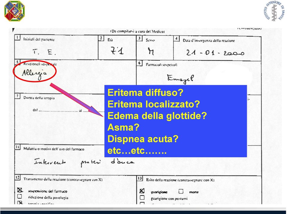 Edema della glottide?