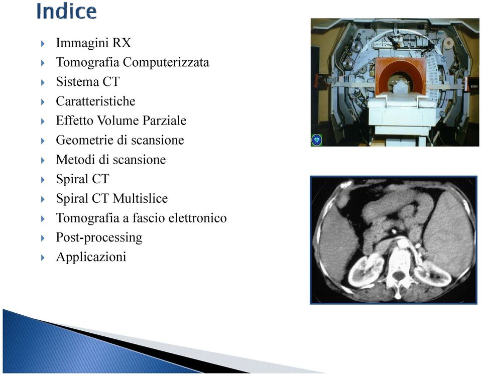 scansione Metodi di scansione Spiral CT Spiral CT