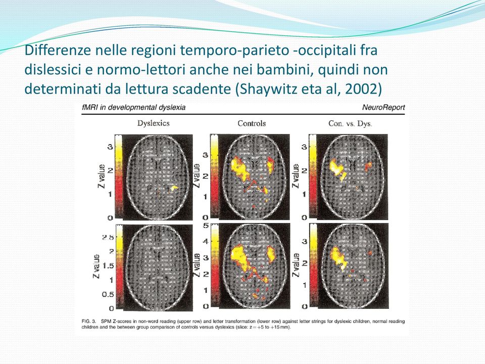 anche nei bambini, quindi non determinati