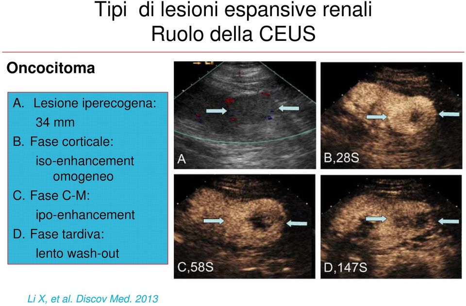 Fase corticale: iso-enhancement omogeneo C.