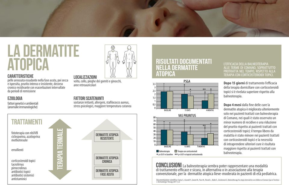 tacrolimus pimecrolinus antibiotici topici antibiotici sistemici antistaminici TERAPIA TERMALE Localizzazioni volto, collo, pieghe dei gomiti e ginocchi, aree retroauricolari Fattori scatenanti