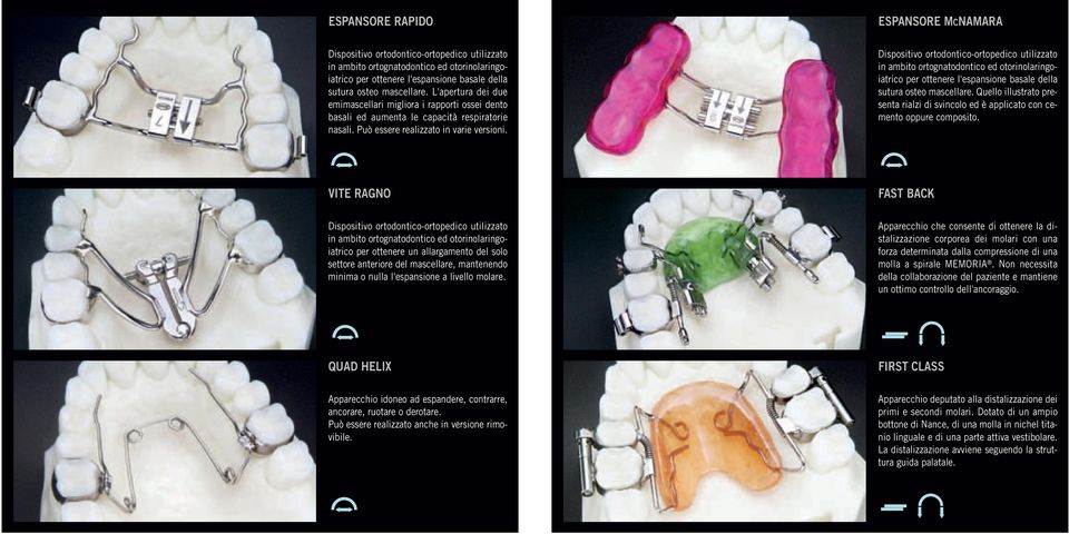 Dispositivo ortodontico-ortopedico utilizzato in ambito ortognatodontico ed otorinolaringoiatrico per ottenere l'espansione basale della sutura osteo mascellare.