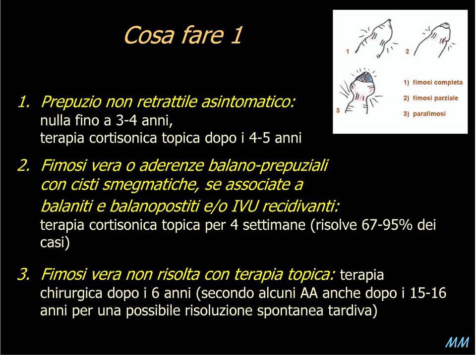 recidivanti: terapia cortisonica topica per 4 settimane (risolve 67-95% dei casi) 3.