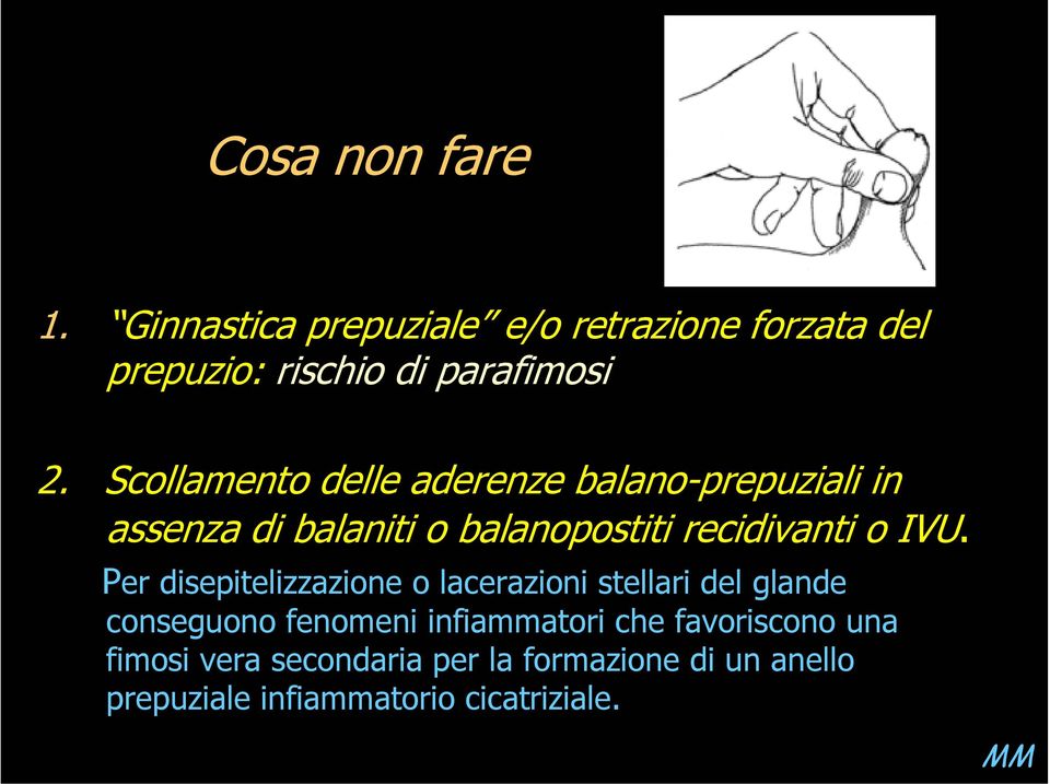 Per disepitelizzazione o lacerazioni stellari del glande conseguono fenomeni infiammatori che