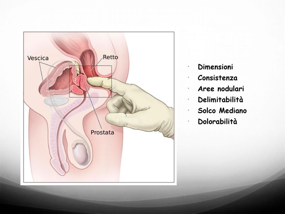 nodulari