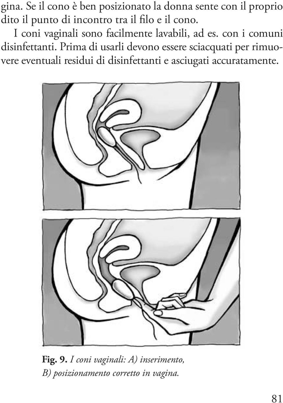 Prima di usarli devono essere sciacquati per rimuovere eventuali residui di disinfettanti e