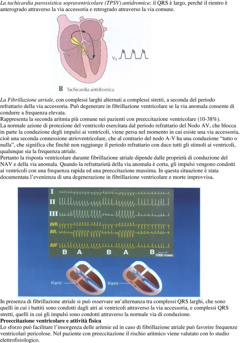 Può degenerare in fibrillazione ventricolare se la via anomala consente di condurre a frequenza elevata.