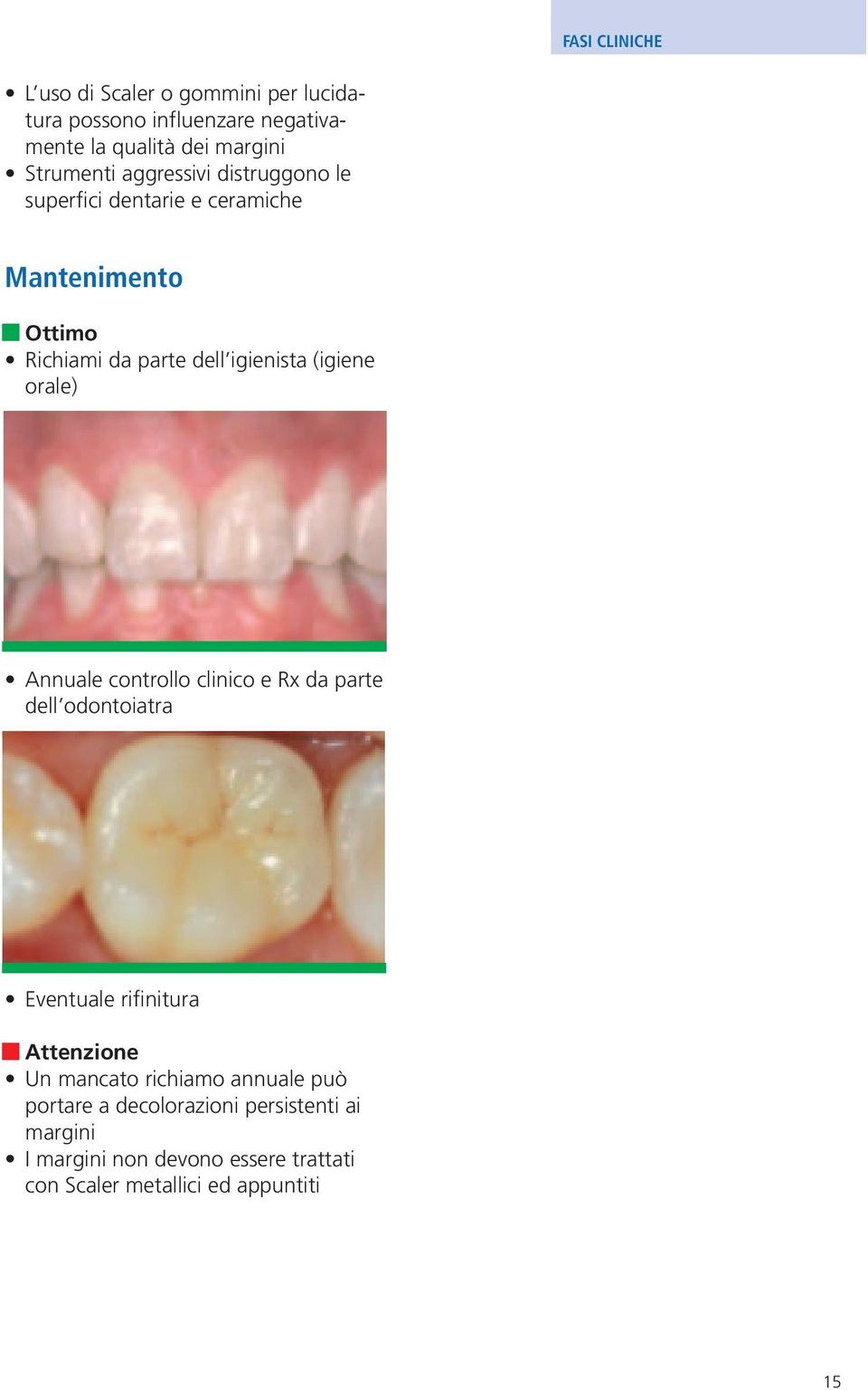 (igiene orale) Annuale controllo clinico e Rx da parte dell odontoiatra Eventuale rifinitura Un mancato richiamo
