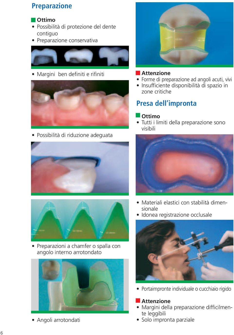 preparazione sono visibili Materiali elastici con stabilità dimensionale Idonea registrazione occlusale Preparazioni a chamfer o spalla con angolo