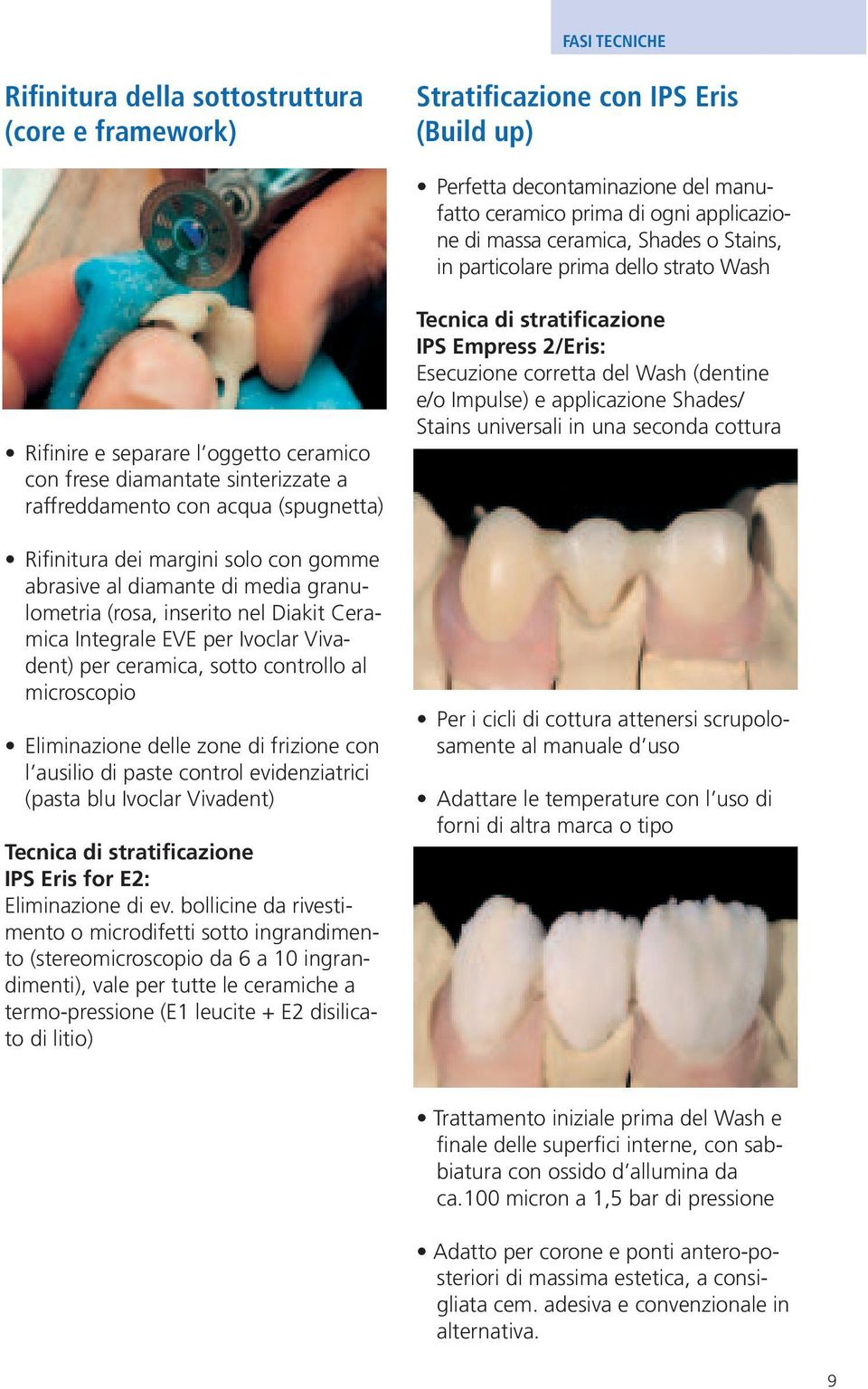 gomme abrasive al diamante di media granulometria (rosa, inserito nel Diakit Ceramica Integrale EVE per Ivoclar Vivadent) per ceramica, sotto controllo al microscopio Eliminazione delle zone di