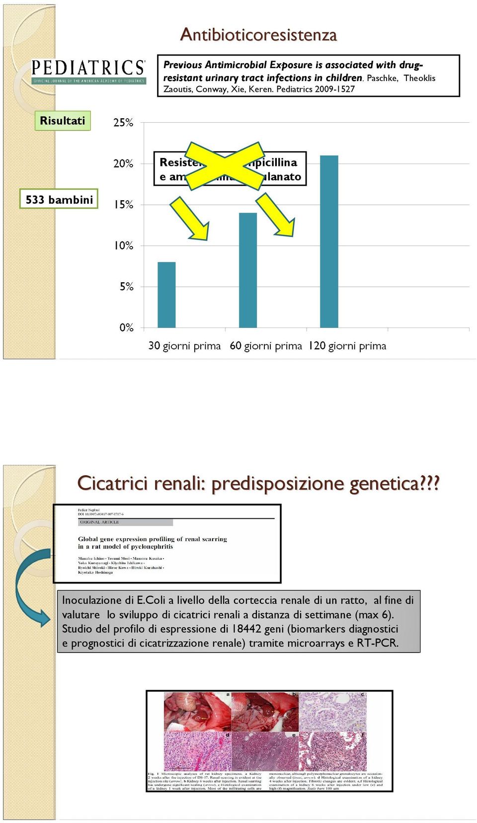 Pediatrics 2009-1527 Risultati Resistenza ad ampicillina e amoxicillina/clavulanato 533 bambini Cicatrici renali: predisposizione genetica?