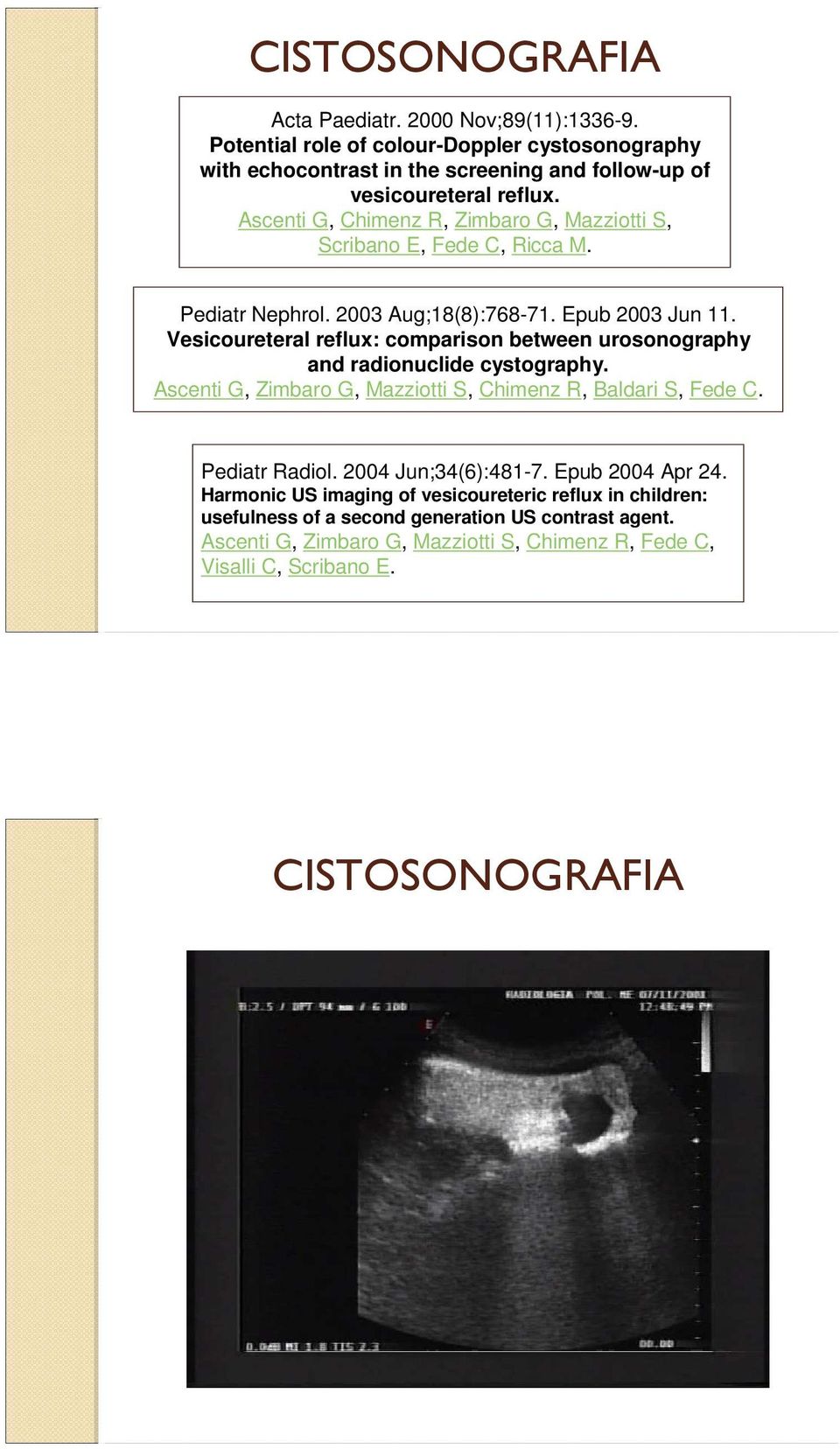 Vesicoureteral reflux: comparison between urosonography and radionuclide cystography. Ascenti G, Zimbaro G, Mazziotti S, Chimenz R, Baldari S, Fede C. Pediatr Radiol.