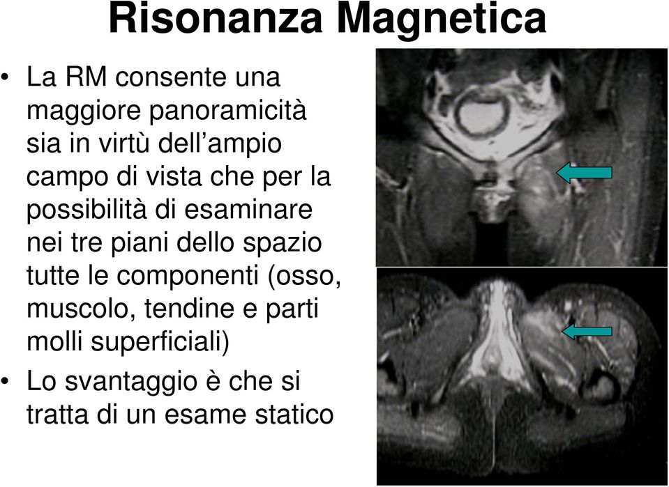 nei tre piani dello spazio tutte le componenti (osso, muscolo, tendine