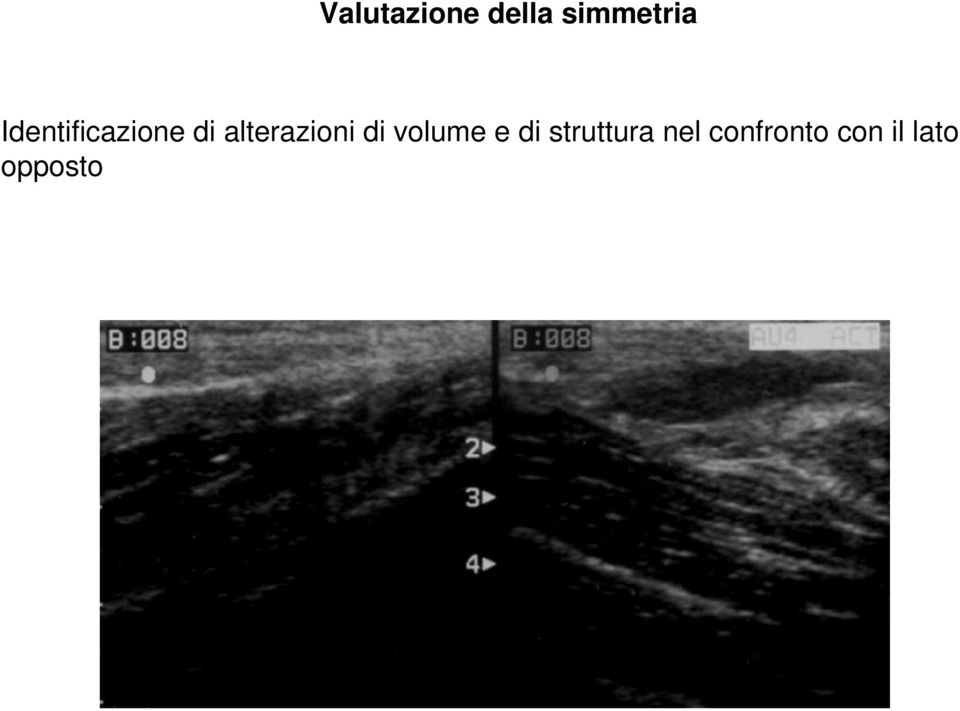 alterazioni di volume e di