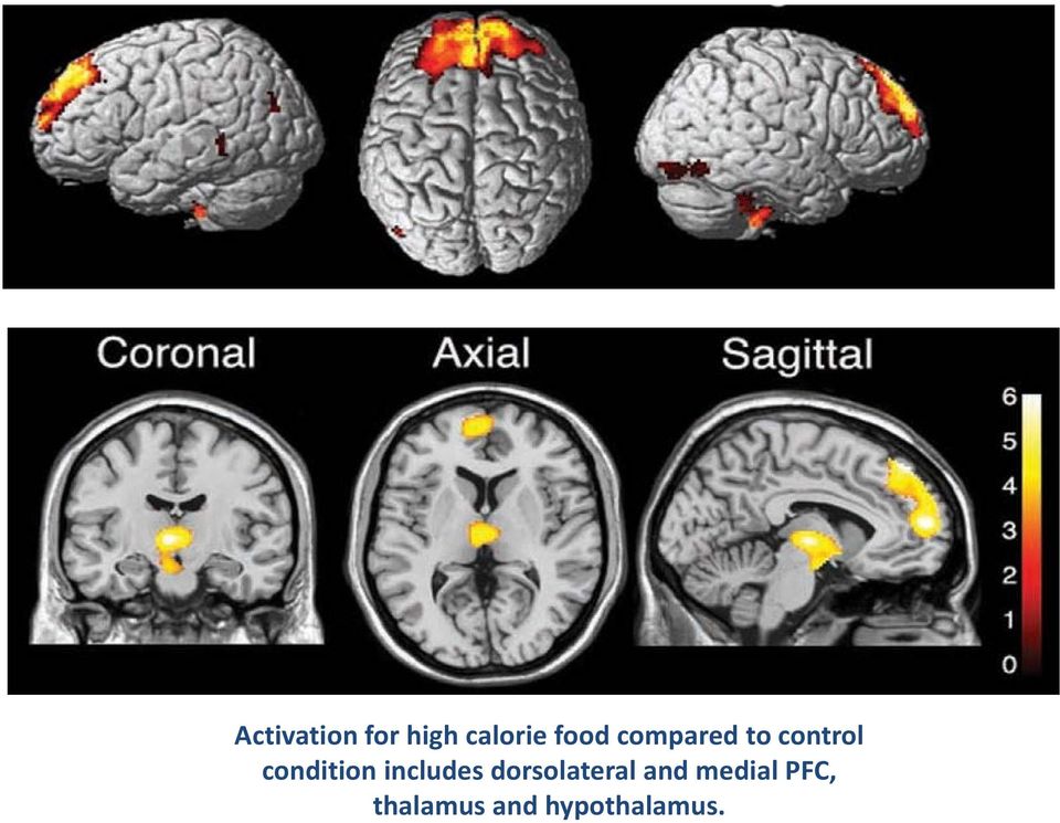 condition includes dorsolateral