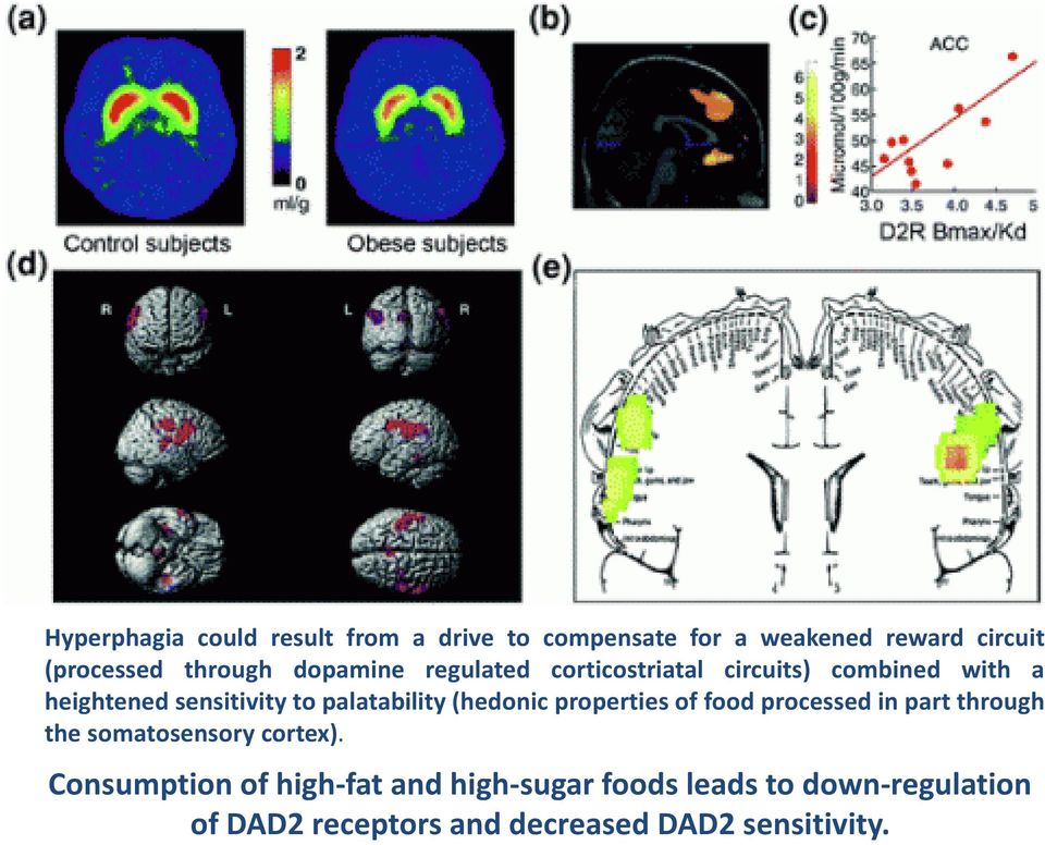 (hedonic properties of food processed in part through the somatosensory cortex).