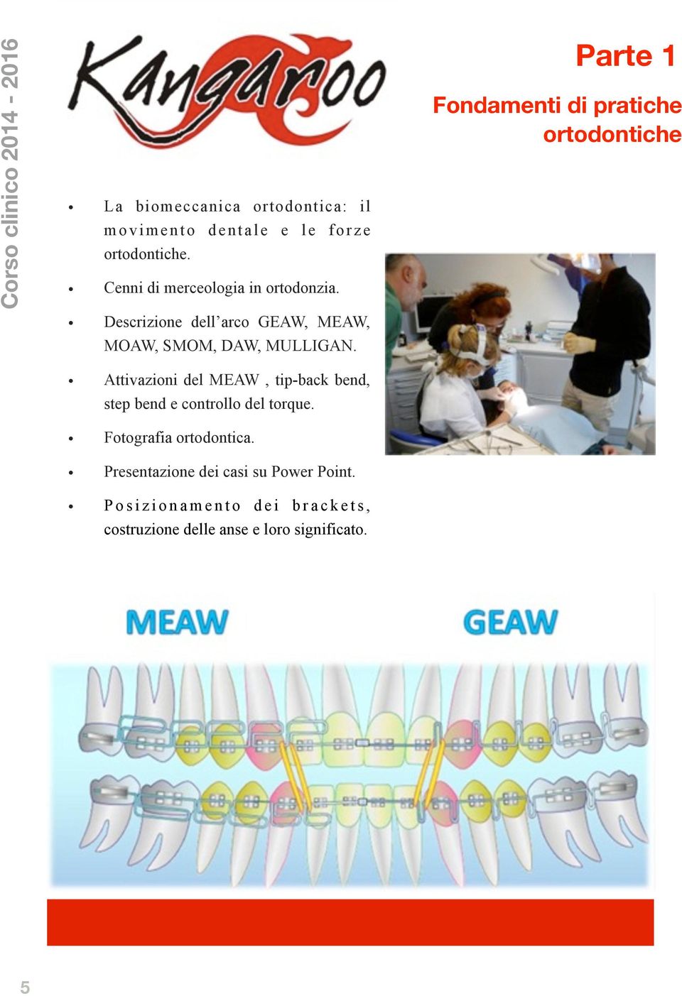 Attivazioni del MEAW, tip-back bend, step bend e controllo del torque. Fotografia ortodontica.