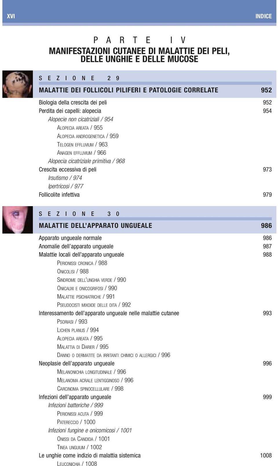 primitiva / 968 Crescita eccessiva di peli 973 Irsutismo / 974 Ipertricosi / 977 Follicolite infettiva 979 S E Z I O N E 3 0 MALATTIE DELL APPARATO UNGUEALE 986 Apparato ungueale normale 986 Anomalie