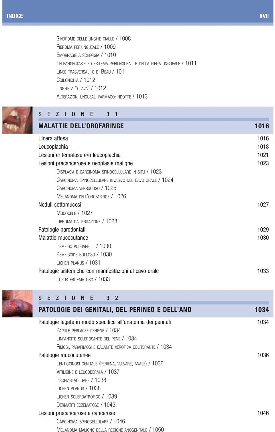 eritematose e/o leucoplachia 1021 Lesioni precancerose e neoplasie maligne 1023 DISPLASIA E CARCINOMA SPINOCELLULARE IN SITU / 1023 CARCINOMA SPINOCELLULARE INVASIVO DEL CAVO ORALE / 1024 CARCINOMA