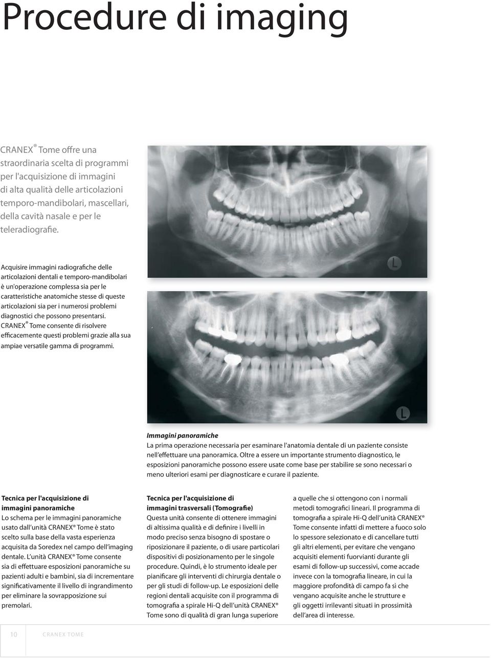 Acquisire immagini radiografiche delle articolazioni dentali e temporo-mandibolari è un'operazione complessa sia per le caratteristiche anatomiche stesse di queste articolazioni sia per i numerosi