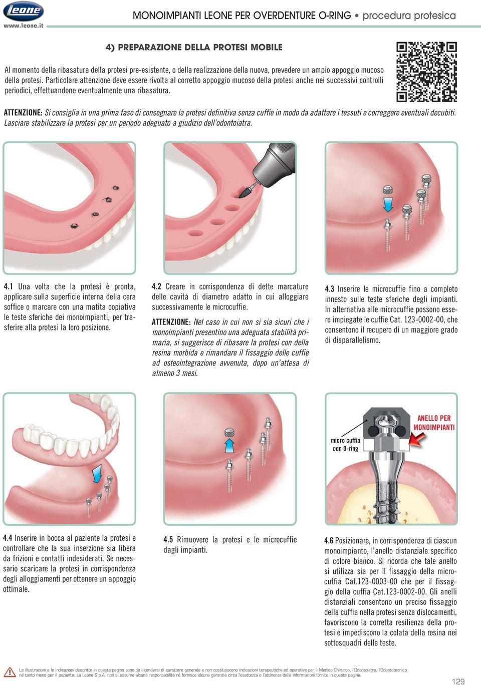 prevedere un ampio appoggio mucoso della protesi.