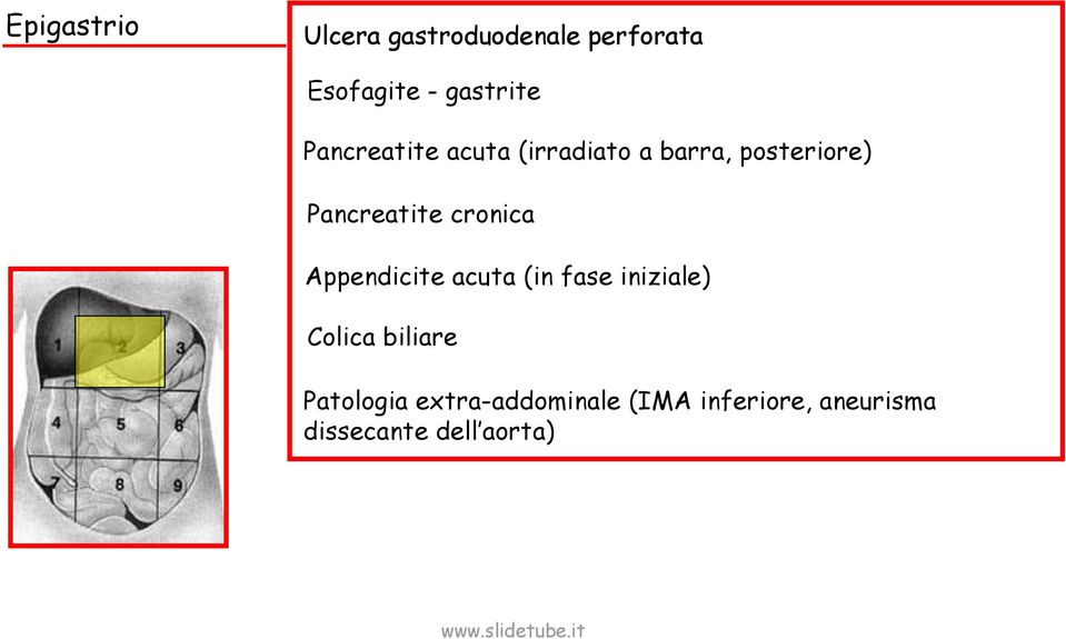 cronica Appendicite acuta (in fase iniziale) Colica biliare