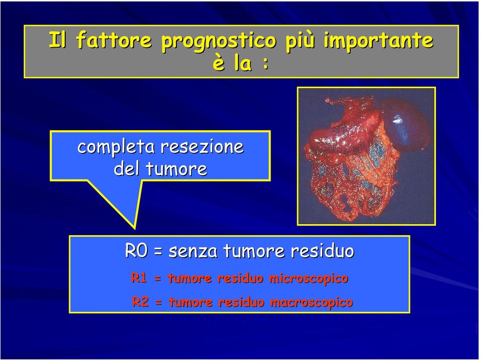 senza tumore residuo R1 = tumore residuo