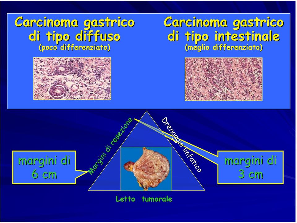 differenziato) margini di 6 cm Margini Margini di resezione