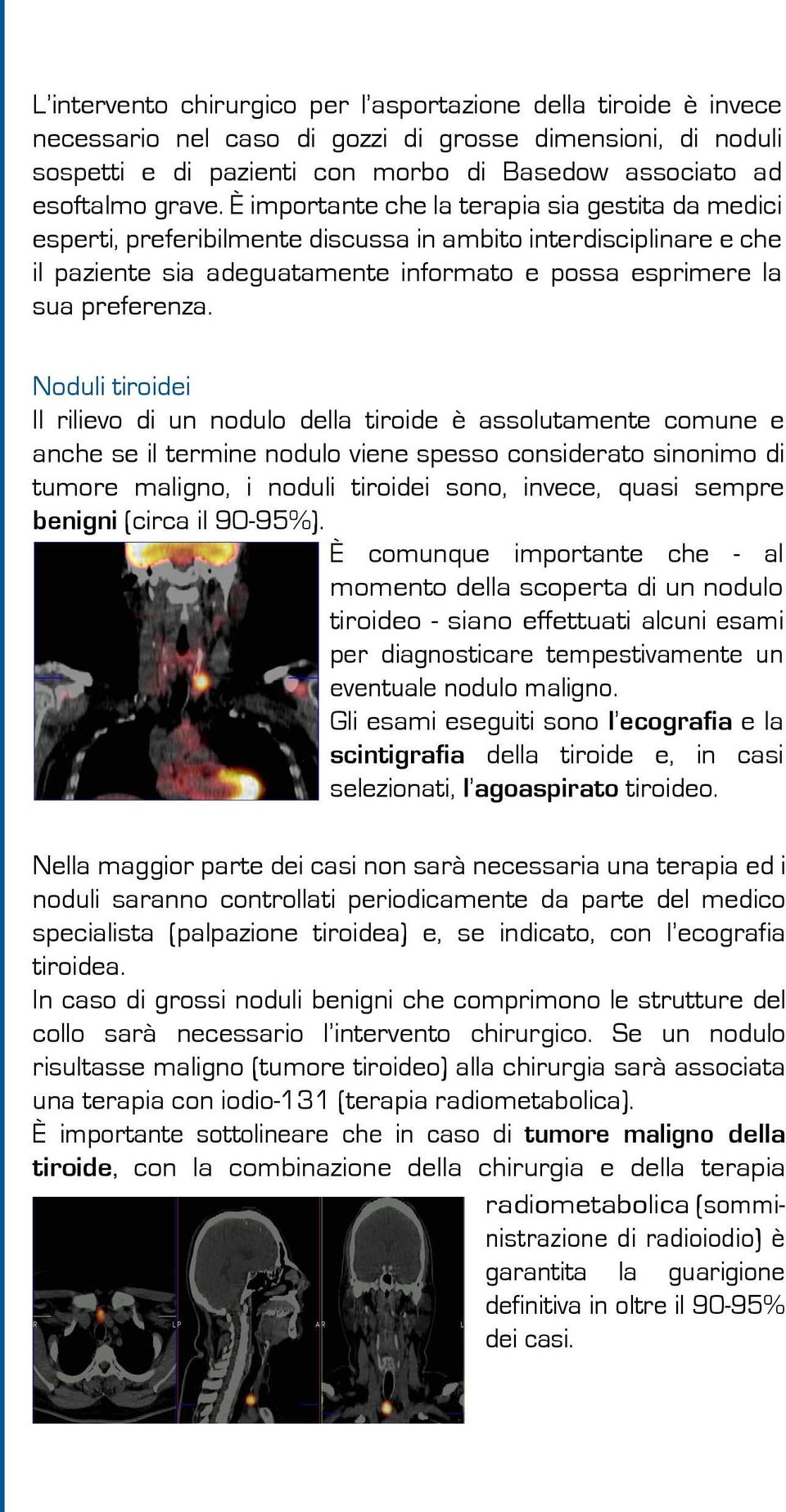 Noduli tiroidei Il rilievo di un nodulo della tiroide è assolutamente comune e anche se il termine nodulo viene spesso considerato sinonimo di tumore maligno, i noduli tiroidei sono, invece, quasi