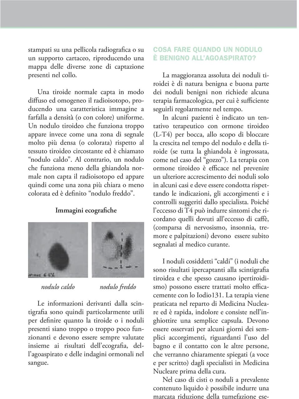 Un nodulo tiroideo che funziona troppo appare invece come una zona di segnale molto più densa (o colorata) rispetto al tessuto tiroideo circostante ed è chiamato nodulo caldo.